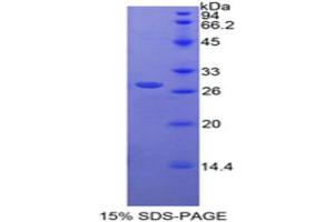 SDS-PAGE analysis of Rat RARa Protein. (Retinoic Acid Receptor alpha Protein)