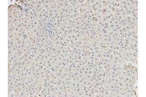 Immunohistochemistry (IHC) image for anti-DEAD (Asp-Glu-Ala-Asp) Box Polypeptide 5 (DDX5) antibody (ABIN1876484) (DDX5 Antikörper)