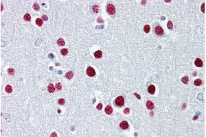 Immunohistochemistry with Brain, cortex tissue at an antibody concentration of 5µg/ml using anti-TUB antibody (ARP33467_P050) (TUB Antikörper  (N-Term))