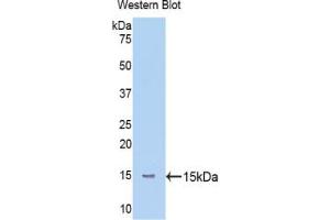 Western blot analysis of the recombinant protein. (Mannose Associated Serine Protease 2 (AA 170-287) Antikörper)