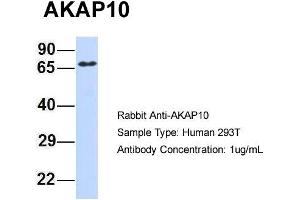 Host: Rabbit Target Name: AKAP10 Sample Type: 293T Antibody Dilution: 1. (AKAP10 Antikörper  (Middle Region))