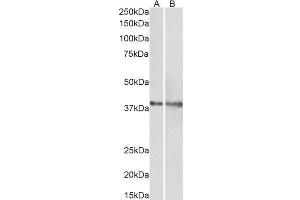 ABIN768559 (1µg/ml) staining of Rat (A) and Pig (B) Heart lysate (35µg protein in RIPA buffer). (IDH3G Antikörper  (AA 337-350))