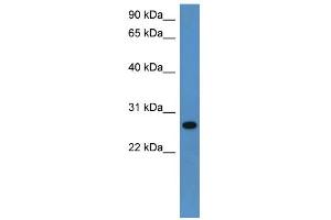 WB Suggested Anti-Cyb5r2 Antibody Titration: 0.