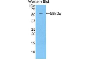 Western Blotting (WB) image for anti-Transglutaminase 1, Keratinocyte (TGM1) (AA 337-607) antibody (ABIN1860739) (TGM1 Antikörper  (AA 337-607))