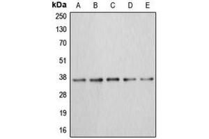 Western blot analysis of Annexin A3 expression in MCF7 (A), HEK293T (B), HepG2 (C), mouse kidney (D), rat liver (E) whole cell lysates. (Annexin A3 Antikörper  (Center))