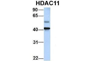 Host:  Rabbit  Target Name:  HDAC11  Sample Type:  Human Adult Placenta  Antibody Dilution:  1. (HDAC11 Antikörper  (Middle Region))