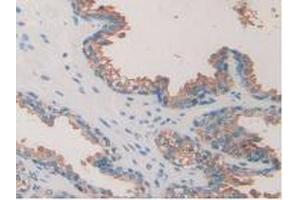 IHC-P analysis of Human Prostate Gland Tissue, with DAB staining. (TOR1A Antikörper  (AA 33-321))