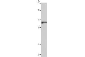 Western Blotting (WB) image for anti-Elastin (ELN) antibody (ABIN2421531) (Elastin Antikörper)