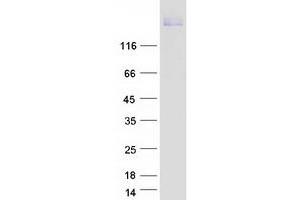 Western Blotting (WB) image for Deleted in Colorectal Carcinoma (DCC) protein (Myc-DYKDDDDK Tag) (ABIN2727109)