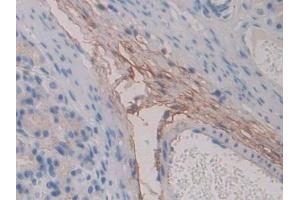 Detection of FBN1 in Rat Stomach Tissue using Polyclonal Antibody to Fibrillin 1 (FBN1) (Fibrillin 1 Antikörper  (AA 751-895))
