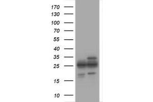 Image no. 1 for anti-Proteasome Subunit alpha 2 (PSMA2) (AA 50-234) antibody (ABIN1491570) (PSMA2 Antikörper  (AA 50-234))