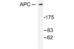 Image no. 1 for anti-Adenomatous Polyposis Coli (APC) antibody (ABIN265313) (APC Antikörper)