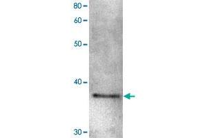 Detection of Shugoshin 1 protein by Western blotting. (Shugoshin Antikörper)