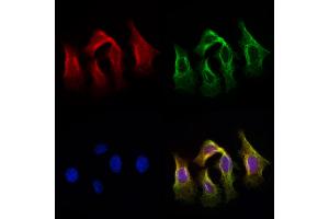 ABIN6259832 and ABIN6279098 staining Hela cells by IF/ICC.