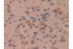 DAB staining on IHC-P; Samples: Mouse Brain Tissue (Pituitary Adenylate Cyclase Activating Peptide (AA 1-175) Antikörper)