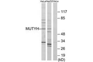 Western blot analysis of extracts from HeLa/HepG2 cells, using MUTYH Antibody. (MUTYH Antikörper  (AA 151-200))