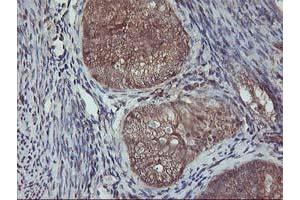 Image no. 1 for anti-V-Akt Murine Thymoma Viral Oncogene Homolog 1 (AKT1) antibody (ABIN1496554) (AKT1 Antikörper)