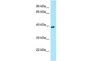 WB Suggested Anti-GPR78 Antibody Titration: 1. (GPR78 Antikörper  (C-Term))
