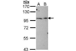 WB Image Sample (30 ug of whole cell lysate) A: Hep G2 , B: Molt-4 , 7. (TBCK Antikörper)