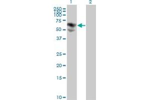 Western Blot analysis of BTD expression in transfected 293T cell line by BTD monoclonal antibody (M01), clone 3B10-2B3. (BTD Antikörper  (AA 1-543))