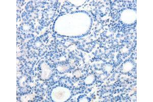 Immunohistochemistry (IHC) image for anti-Secretin Receptor (SCTR) antibody (ABIN1874706) (SCTR Antikörper)