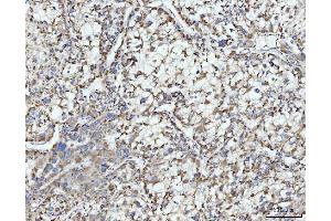 IHC analysis of ECSIT using anti-ECSIT antibody (ABIN7602543). (ECSIT Antikörper  (AA 83-339))