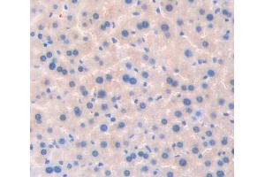 Used in DAB staining on fromalin fixed paraffin- embedded liver tissue (TSSK1 Antikörper  (AA 57-314))