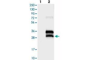 Western blot analysis of Lane 1: Negative control (vector only transfected HEK293T lysate), Lane 2: Over-expression Lysate (Co-expressed with a C-terminal myc-DDK tag (~3. (BRICD5 Antikörper)