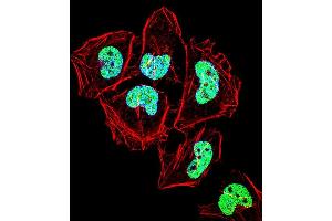 Fluorescent confocal image of Hela cell stained with ZN Antibody (C-term) (ABIN1537388 and ABIN2848620). (ZNF155 Antikörper  (C-Term))