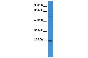 Western Blot showing GADD45A antibody used at a concentration of 1-2 ug/ml to detect its target protein.