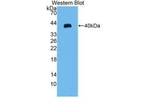 Detection of Recombinant MIP3a, Rat using Monoclonal Antibody to Macrophage Inflammatory Protein 3 Alpha (MIP3a) (CCL20 Antikörper  (AA 24-95))