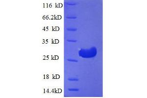 SDS-PAGE (SDS) image for Cathepsin F (CTSF) (AA 273-484), (partial) protein (His tag) (ABIN1046784)