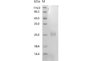 (Tris-Glycine gel) Discontinuous SDS-PAGE (reduced) with 5 % enrichment gel and 15 % separation gel.