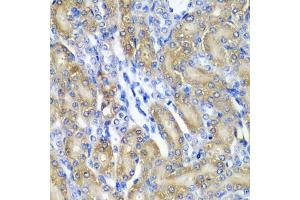 Immunohistochemistry of paraffin-embedded rat kidney using CRYAA antibody (ABIN5973354) at dilution of 1/200 (40x lens). (CRYAA Antikörper)