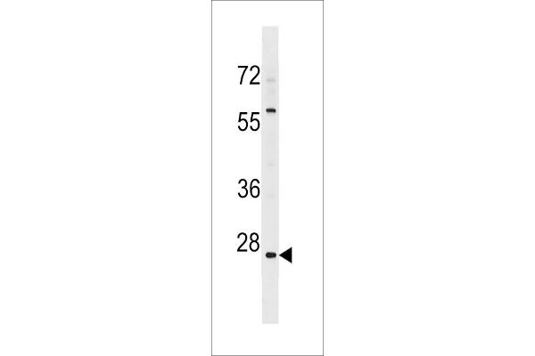 HMGN5 antibody  (N-Term)