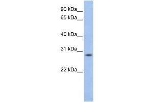 Western Blotting (WB) image for anti-MPV17 Mitochondrial Membrane Protein-Like 2 (MPV17L2) antibody (ABIN2459191) (MPV17L2 Antikörper)