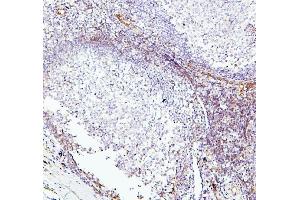 IHC analysis of TEK using anti-TEK antibody (ABIN7600762). (TEK Antikörper  (AA 23-616))