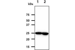 The cell lysates (40ug) were resolved by SDS-PAGE, transferred to PVDF membrane and probed with anti-human NNMT antibody (1:1000).