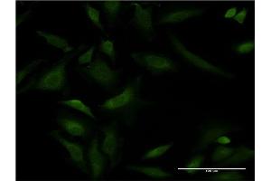Immunofluorescence of monoclonal antibody to ATP2A1 on HeLa cell. (ATP2A1/SERCA1 Antikörper  (AA 522-612))