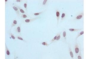 Immunocytochemistry analysis of ABIN7127304 diluted at 1:100 and staining in Hela cells performed on a Leica BondTM system. (Rekombinanter HIST1H3A Antikörper  (H3R2me))