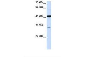 Image no. 1 for anti-Glutaryl-CoA Dehydrogenase (GCDH) (AA 146-195) antibody (ABIN6738082) (GCDH Antikörper  (AA 146-195))
