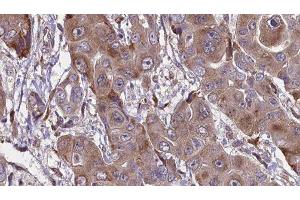 Immunohistochemistry (IHC) image for anti-Fc Fragment of IgG, High Affinity Ia, Receptor (CD64) (FCGR1A) (Internal Region) antibody (ABIN6261700)