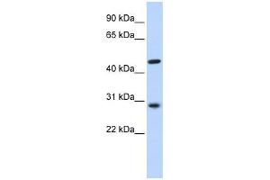 PYGO2 antibody used at 0. (PYGO2 Antikörper  (N-Term))