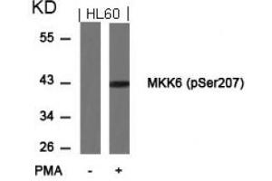 Image no. 3 for anti-Mitogen-Activated Protein Kinase Kinase 6 (MAP2K6) (pSer207) antibody (ABIN196864) (MAP2K6 Antikörper  (pSer207))