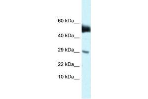 WB Suggested Anti-Amhr2 Antibody   Titration: 1.