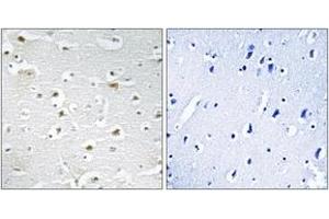 Immunohistochemistry analysis of paraffin-embedded human brain tissue, using DDX3Y Antibody. (DDX3Y Antikörper  (AA 41-90))
