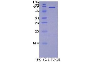 SDS-PAGE (SDS) image for Arginase, Type II (ARG2) (AA 23-354) protein (His tag) (ABIN1878488)