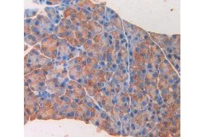 IHC-P analysis of pancreas tissue, with DAB staining. (GAD Antikörper  (AA 1-97))