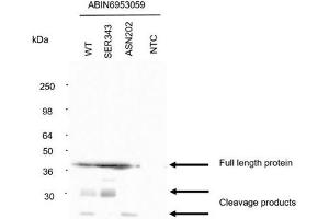 Western Blotting (WB) image for anti-SARS-CoV-2 Nucleocapsid (SARS-CoV-2 N) antibody (ABIN6953059)