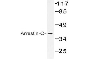 Western blot (WB) analysis of Arrestin-C antibody in extracts from LOVO cells. (ARR3 Antikörper)